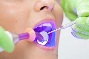 img-Laser-Dentistry