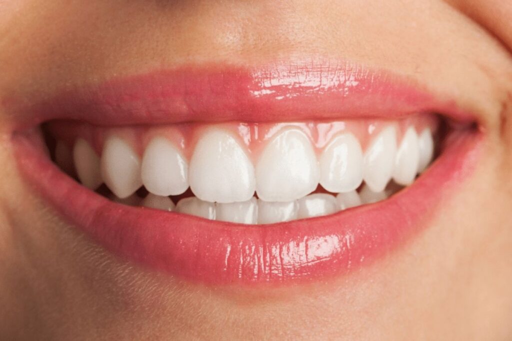 dental bonding in twin falls