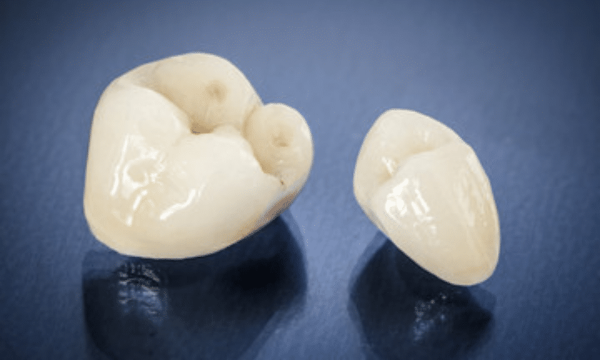 Know all about dental crowns