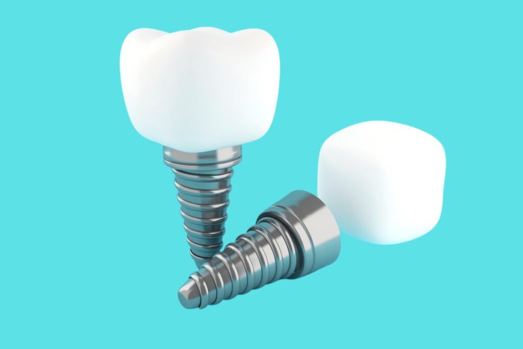 dental implants