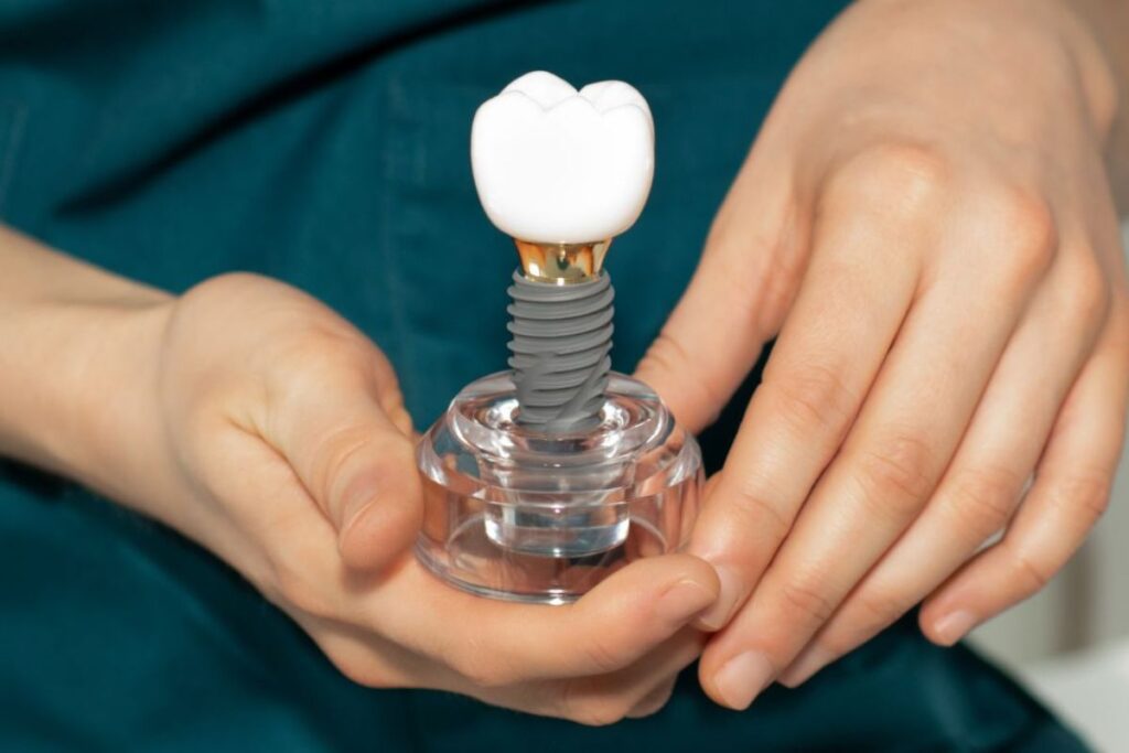dental implants