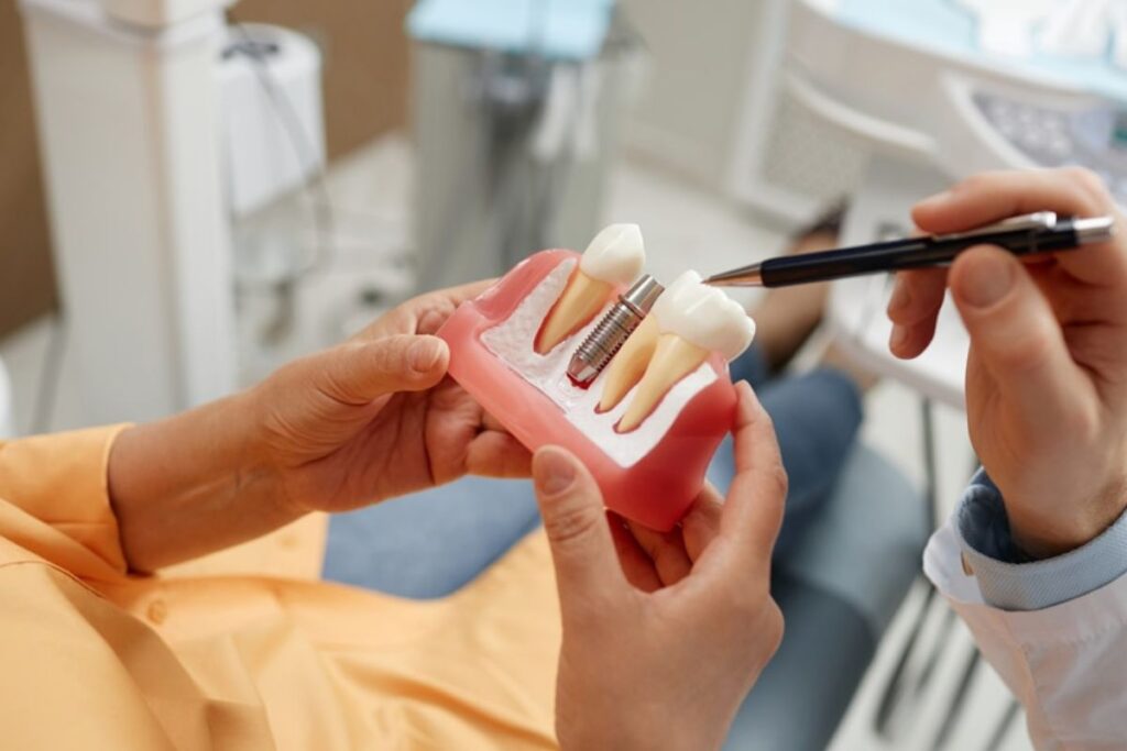 broken dental implants