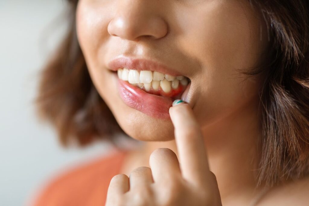 causes of gum disease