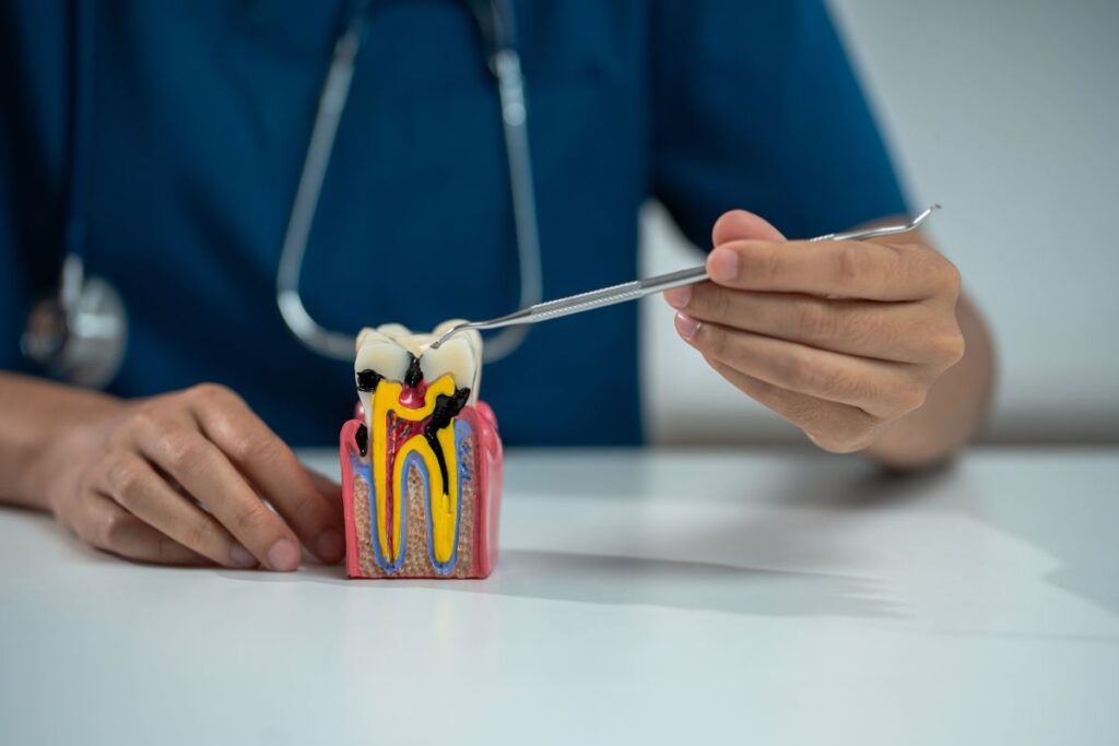 root canal recovery