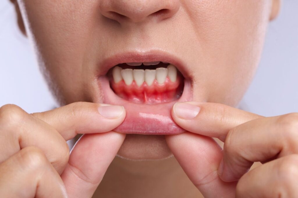 effects of gum disease