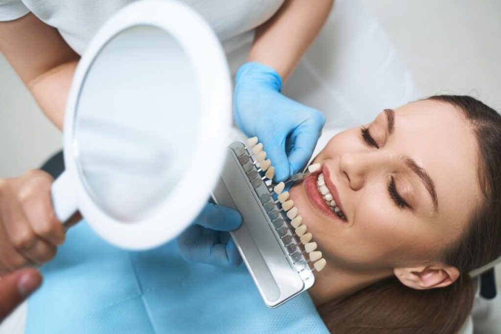 good candidate for dental veneers