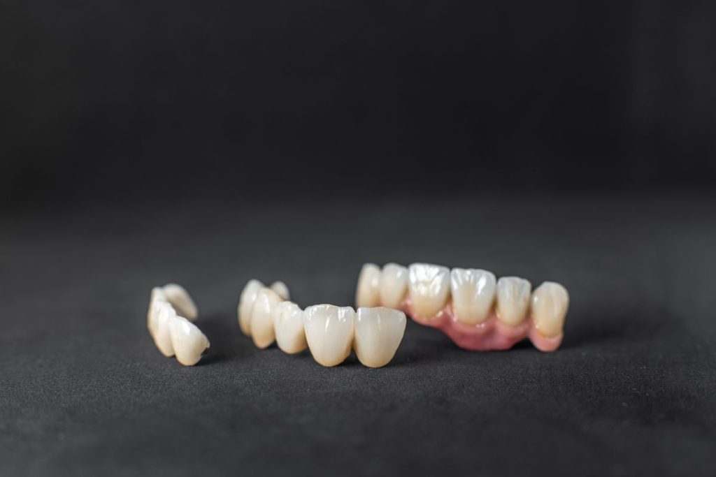 how long do dental crowns last