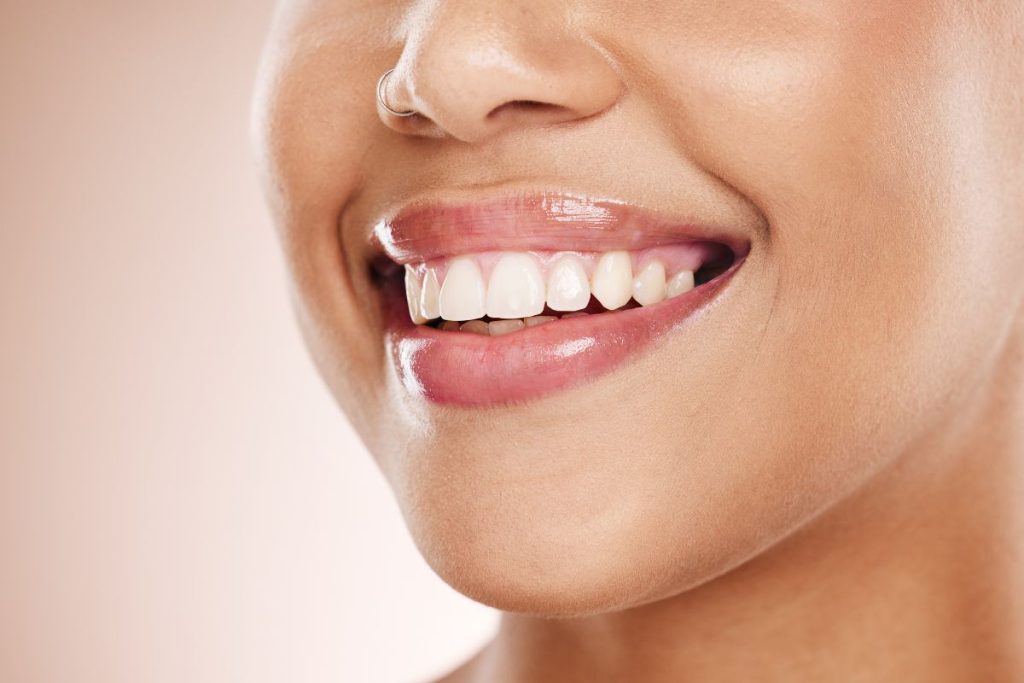 Signs You Need Professional Teeth Whitening